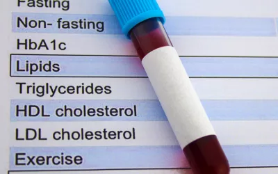 Why Do Unhealthy Cholesterol Levels Increase in Menopausal Women?