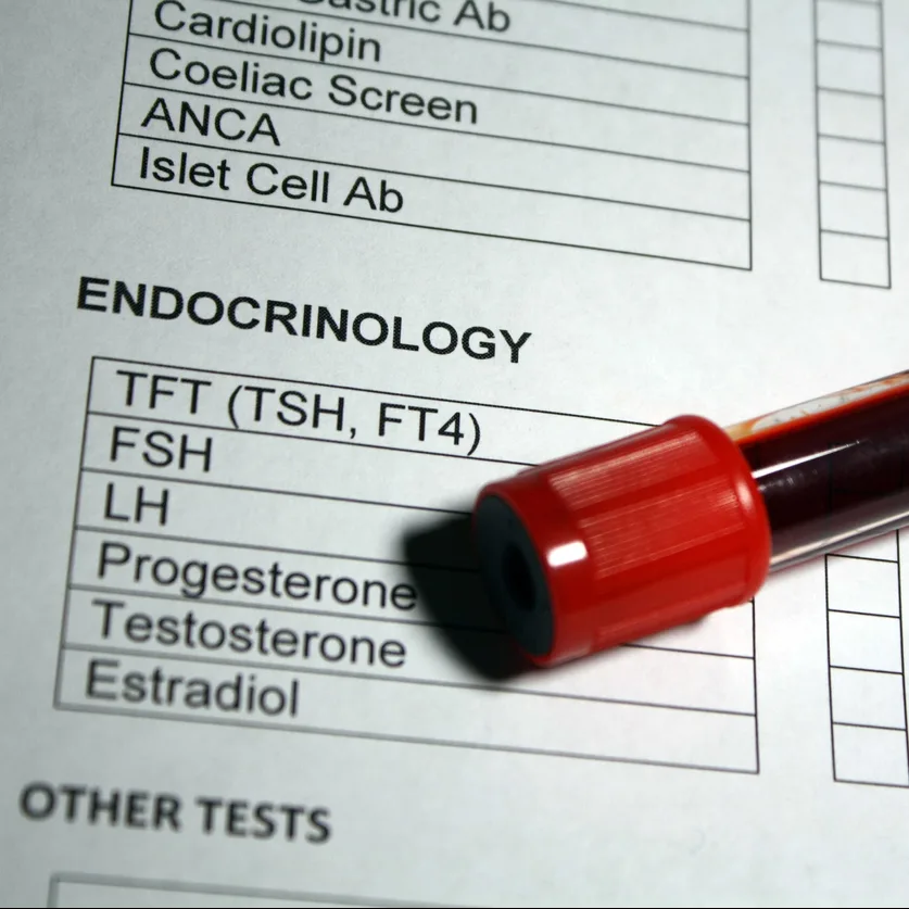 endocrinology lab test