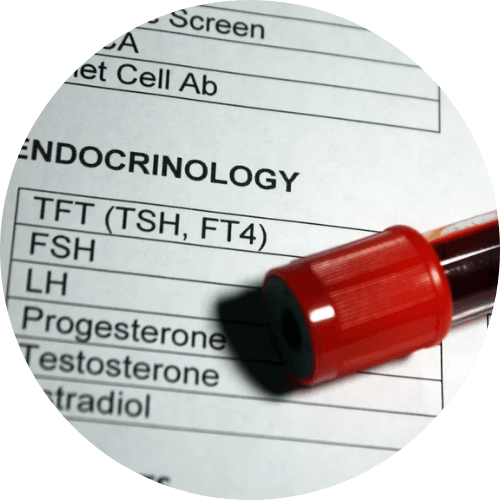 endocrinology lab test